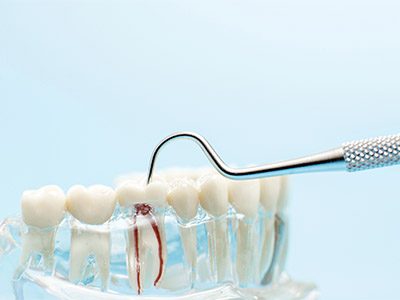 Restorative Dentistry