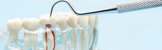 Restorative Dentistry