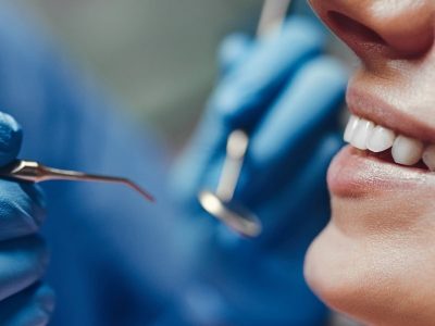 Sub-page-bannes-min-aspect-ratio-400-300 Centre Smiles Dental